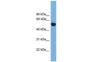 EPHX1 antibody used at 1 ug/ml to detect target protein. (EPHX1 anticorps)