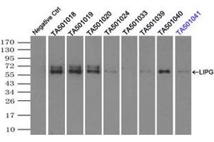 Image no. 2 for anti-Lipase, Endothelial (LIPG) antibody (ABIN1499167) (LIPG anticorps)
