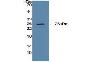 Detection of Recombinant CCNB, Human using Polyclonal Antibody to Cyclin B (CCNB)