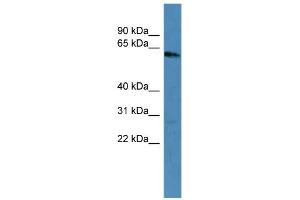 WB Suggested Anti-KRT3 Antibody Titration: 0. (Keratin 3 anticorps  (C-Term))