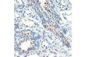 Immunohistochemistry of paraffin-embedded mouse lung using RPS6K antibody (ABIN6129296, ABIN6147232, ABIN6147233 and ABIN6214270) at dilution of 1:200 (40x lens).