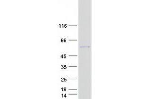 Validation with Western Blot
