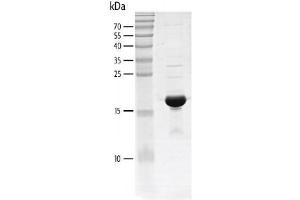 Recombinant CREBBP (1081-1197) protein gel.