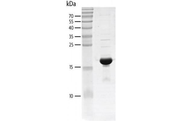 CBP Protein (AA 1081-1197) (His tag,DYKDDDDK Tag)
