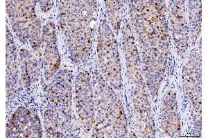 IHC analysis of Cdk2 using anti-Cdk2 antibody (ABIN7602522). (CDK2 anticorps  (AA 81-298))