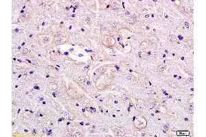 Formalin-fixed and paraffin embedded rat brain labeled with Anti GPR55 Polyclonal Antibody, Unconjugated (ABIN872750) at 1:200 followed by conjugation to the secondary antibody and DAB staining. (GPR55 anticorps  (AA 141-240))