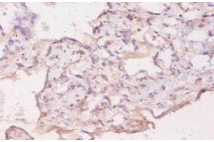 Immunohistochemistry of paraffin-embedded human placenta tissue using ABIN7177253 at dilution of 1:20 (GDF5 anticorps  (AA 376-495))