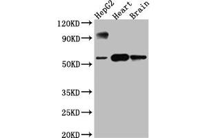 Western Blot Positive WB detected in: HepG2 whole cell lysate, Rat Heart whole cell lysate, Rat Brain whole cell lysate All lanes: CYP17A1 antibody at 1:1000 Secondary Goat polyclonal to rabbit IgG at 1/50000 dilution Predicted band size: 58 kDa Observed band size: 58 kDa