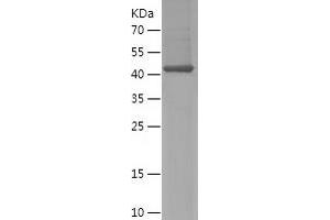 Western Blotting (WB) image for SH3-Domain Binding Protein 4 (SH3BP4) (AA 615-963) protein (His tag) (ABIN7125082)