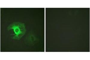 Immunofluorescence analysis of HeLa cells, using Caldesmon (Ab-789) Antibody. (Caldesmon anticorps  (AA 744-793))