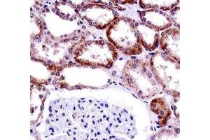 CD70 antibody immunohistochemistry analysis in formalin fixed and paraffin embedded human kidney tissue.