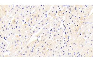 Detection of FNDC5 in Human Cardiac Muscle Tissue using Polyclonal Antibody to Fibronectin Type III Domain Containing Protein 5 (FNDC5)