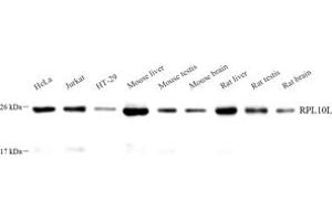 Western blot analysis of RPL10L (ABIN7075429) at dilution of 1: 1000 (RPL10L anticorps)