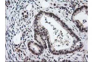 Image no. 10 for anti-Protein Kinase C, epsilon (PRKCE) antibody (ABIN1500229)