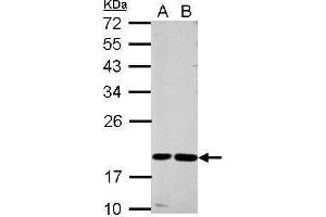 WB Image Sample (30 ug of whole cell lysate) A: A549 B: MCF-7 12% SDS PAGE antibody diluted at 1:1000 (CST7 anticorps)