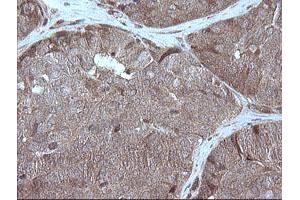 Image no. 1 for anti-Mitogen-Activated Protein Kinase Kinase 1 (MAP2K1) antibody (ABIN1499381)