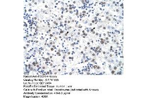 Rabbit Anti-FECH Antibody  Paraffin Embedded Tissue: Human Liver Cellular Data: Hepatocytes Antibody Concentration: 4. (FECH anticorps  (N-Term))