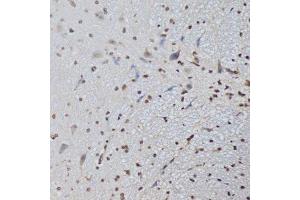 Chromatin immunoprecipitation analysis extracts of HCT116 cells, using CTCF antibody.