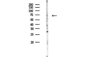 Western blot analysis of lysates from Hela cells(UV 30 min treatment), using GNAS Antibody at 1/1000 dilution.