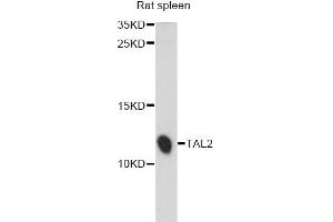 Western blot analysis of extracts of rat spleen, using TAL2 antibody (ABIN6292514) at 1:1000 dilution.