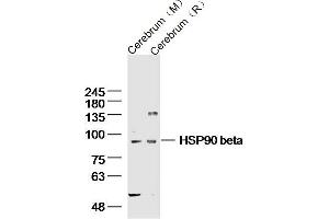 Lane 1: mouse cerebrum lysates Lane 2: rat cerebrum lysates probed with HSP90 beta Polyclonal Antibody, Unconjugated  at 1:300 dilution and 4˚C overnight incubation. (HSP90AB1 anticorps  (AA 635-724))