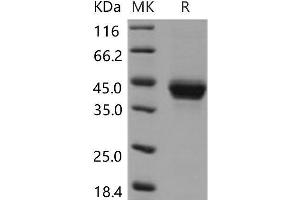 Western Blotting (WB) image for Fc Fragment of IgE, Low Affinity II, Receptor For (CD23) (FCER2) protein (His tag) (ABIN7195673)