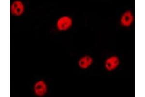 ABIN6275260 staining Hela by IF/ICC. (MLF1 anticorps  (Internal Region))