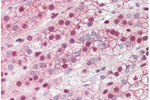 Human Adrenal: Formalin-Fixed, Paraffin-Embedded (FFPE)