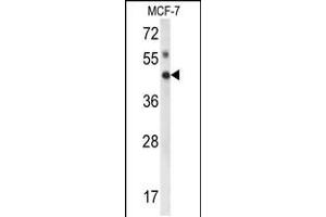Western blot analysis of IPMK Antibody in MCF-7 cell line lysates (35ug/lane) (IPMK anticorps  (AA 300-329))