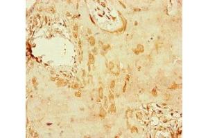 Immunohistochemistry of paraffin-embedded human placenta tissue using ABIN7150406 at dilution of 1:100 (CCDC111 anticorps  (AA 305-537))