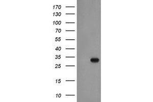 Western Blotting (WB) image for anti-Exosome Component 3 (EXOSC3) antibody (ABIN1498138) (EXOSC3 anticorps)
