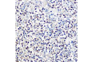 Immunohistochemistry of paraffin-embedded human spleen using CD80 Rabbit pAb (ABIN7266220) at dilution of 1:100 (40x lens). (CD80 anticorps  (AA 1-100))