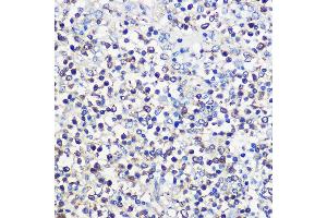 Immunohistochemistry of paraffin-embedded human spleen using CD80 Rabbit pAb (ABIN7266220) at dilution of 1:100 (40x lens).