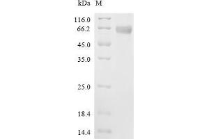 WNT1 Inducible Signaling Pathway Protein 1 (WISP1) (AA 20-371), (full length) protein (His tag)