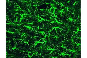 Immunofluorescence staining of a mouse brain section.