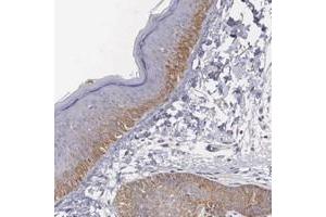 Immunohistochemical staining of human skin with NREP polyclonal antibody  shows moderate cytoplasmic positivity in epidermal and adnexal cells.