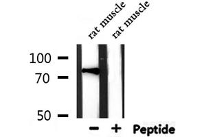 Western blot analysis of extracts from rat muscle, using TACC3 Antibody.