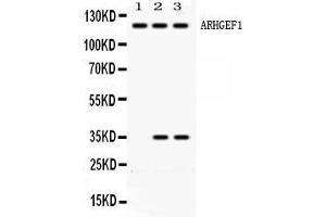 Western blot analysis of ARHGEF1 expression in rat brain extract ( Lane 1), HELA whole cell lysates ( Lane 2) and JURKAT whole cell lysates ( Lane 3). (ARHGEF1 anticorps  (N-Term))