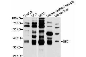 Western blot analysis of extracts of various cell lines, using SIX1 antibody (ABIN5998814) at 1:3000 dilution. (SIX Homeobox 1 anticorps)