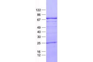 Validation with Western Blot