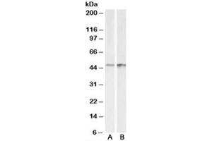 Western blot testing of A431 [A] and HeLa [B] lysates with E2F4 antibody at 0.