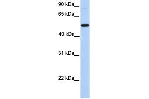 GALNT13 antibody used at 1 ug/ml to detect target protein. (GALNT13 anticorps  (N-Term))