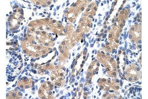 RAE1 antibody was used for immunohistochemistry at a concentration of 4-8 ug/ml to stain Epithelial cells of renal tubule (arrows) in Human Kidney.