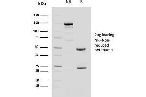 SDS-PAGE Analysis Purified MUC4 Mouse Monoclonal Antibody (MUC4/3084).