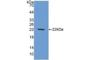Western blot analysis of recombinant Mouse NOS1. (NOS1 anticorps  (AA 53-247))