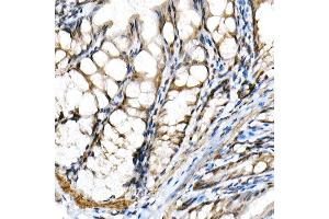 Immunohistochemistry of paraffin-embedded mouse colon using BHLHE40 Rabbit pAb (ABIN6129354, ABIN6137550, ABIN6137551 and ABIN6222195) at dilution of 1:150 (40x lens).