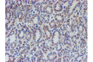 Image no. 1 for anti-Acyl-CoA Synthetase Family Member 2 (ACSF2) antibody (ABIN1496423)