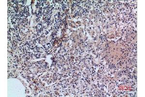 Immunohistochemistry (IHC) analysis of paraffin-embedded Human Lung, antibody was diluted at 1:100. (CD38 anticorps  (Internal Region))