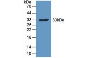 Detection of Recombinant PDHX, Mouse using Polyclonal Antibody to Pyruvate Dehydrogenase Complex Component X (PDHX) (PDHX anticorps  (AA 222-471))