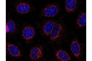 Immunocytochemistry staining of HeLa human cervix carcinoma cell line using anti-STIM1 (CDN3H4, methanol-aceton fixation, detection by Goat anti-mouse IgG1 Alexa Fluor 598, red). (STIM1 anticorps  (C-Term))